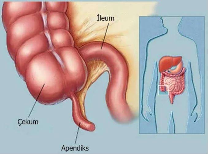 Apandisit nedir? Apandisit gereksiz bir organ mı? 16